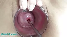 Một người đàn ông tố ...